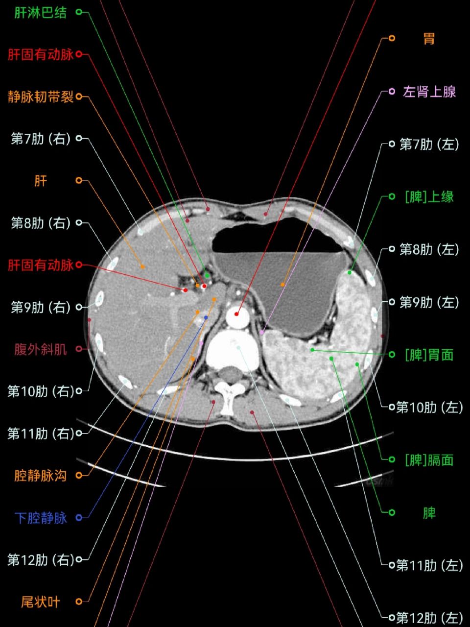 【影像解剖】腹部ct断层解剖图谱(app) 极力推荐的一个影像解剖学习