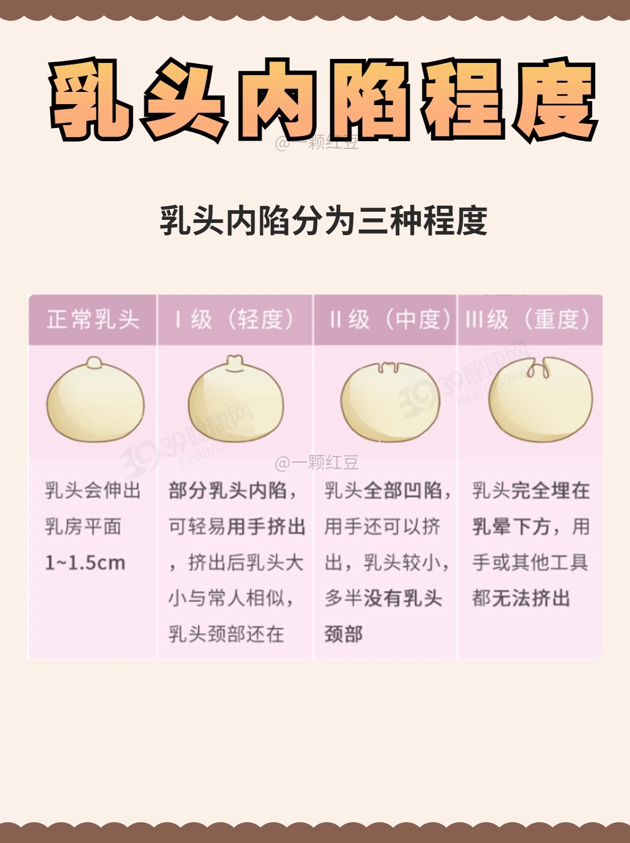 乳头内陷支架法图片