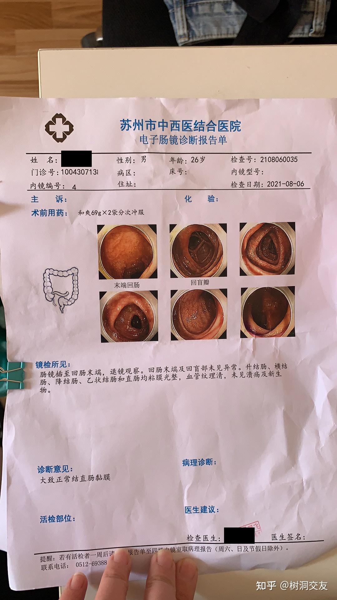 回肠末端肠镜正常照片图片