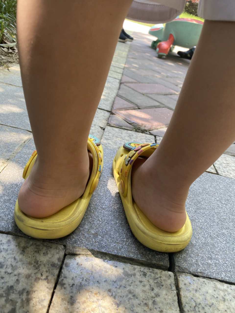 三岁宝宝足外翻扁平足怎么办宝妈们 宝宝刚三岁,以前没有注意这个问题