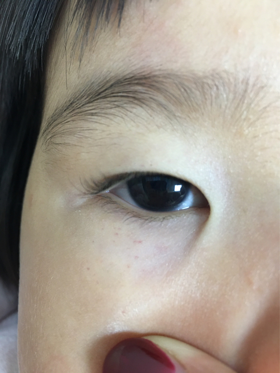 刚刚跟宝宝玩耍,突然发现她眼睛周围的红色点点,不仔细看看不出来的