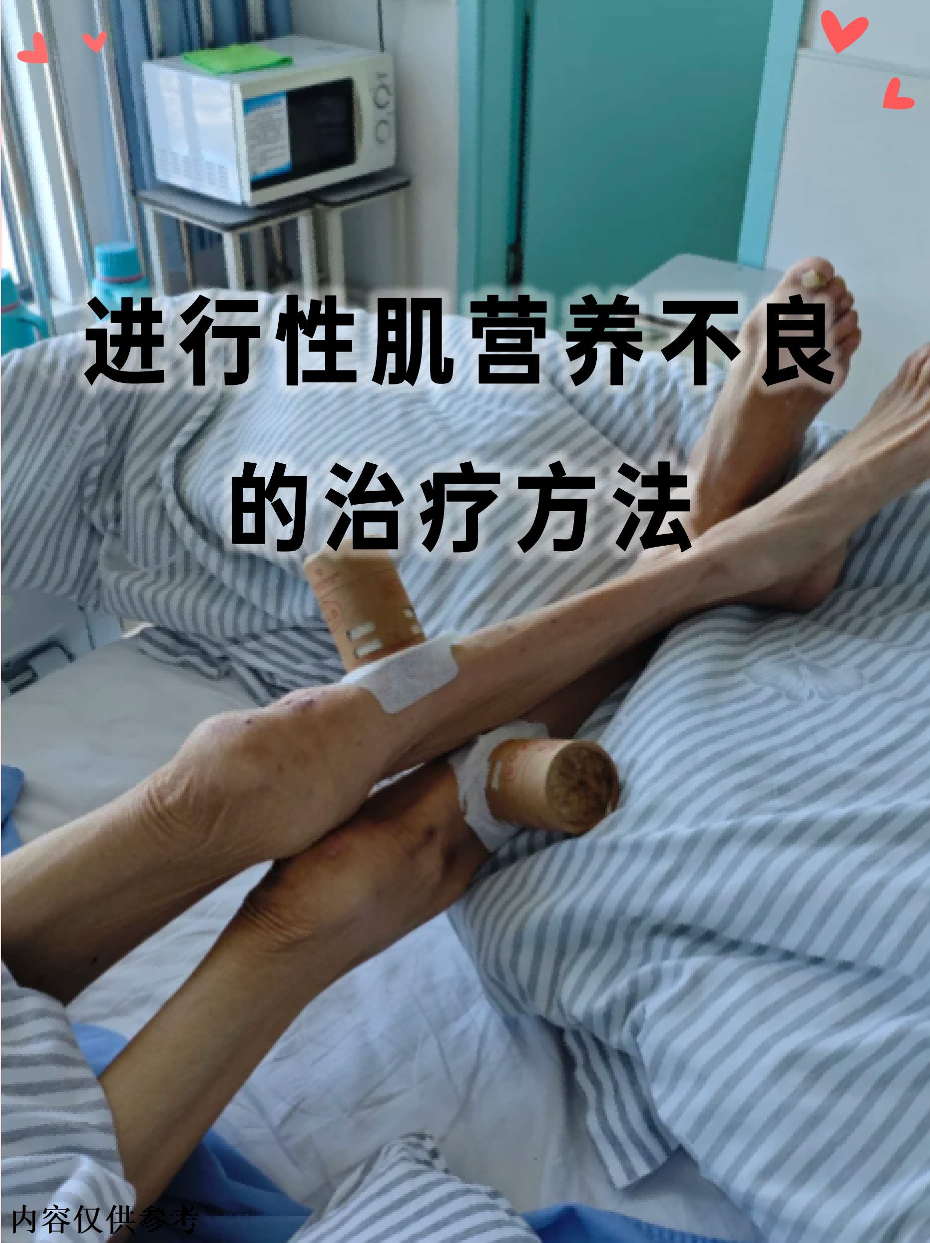 进行性肌营养不良的治疗方法