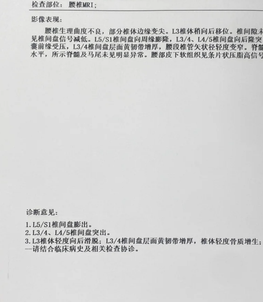 腰上骨头突出可能有几种原因,最常见的是腰椎棘突