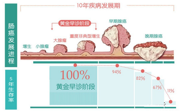 肛门指检能摸出九成直肠癌   直肠癌前期有什么症状  直肠位于