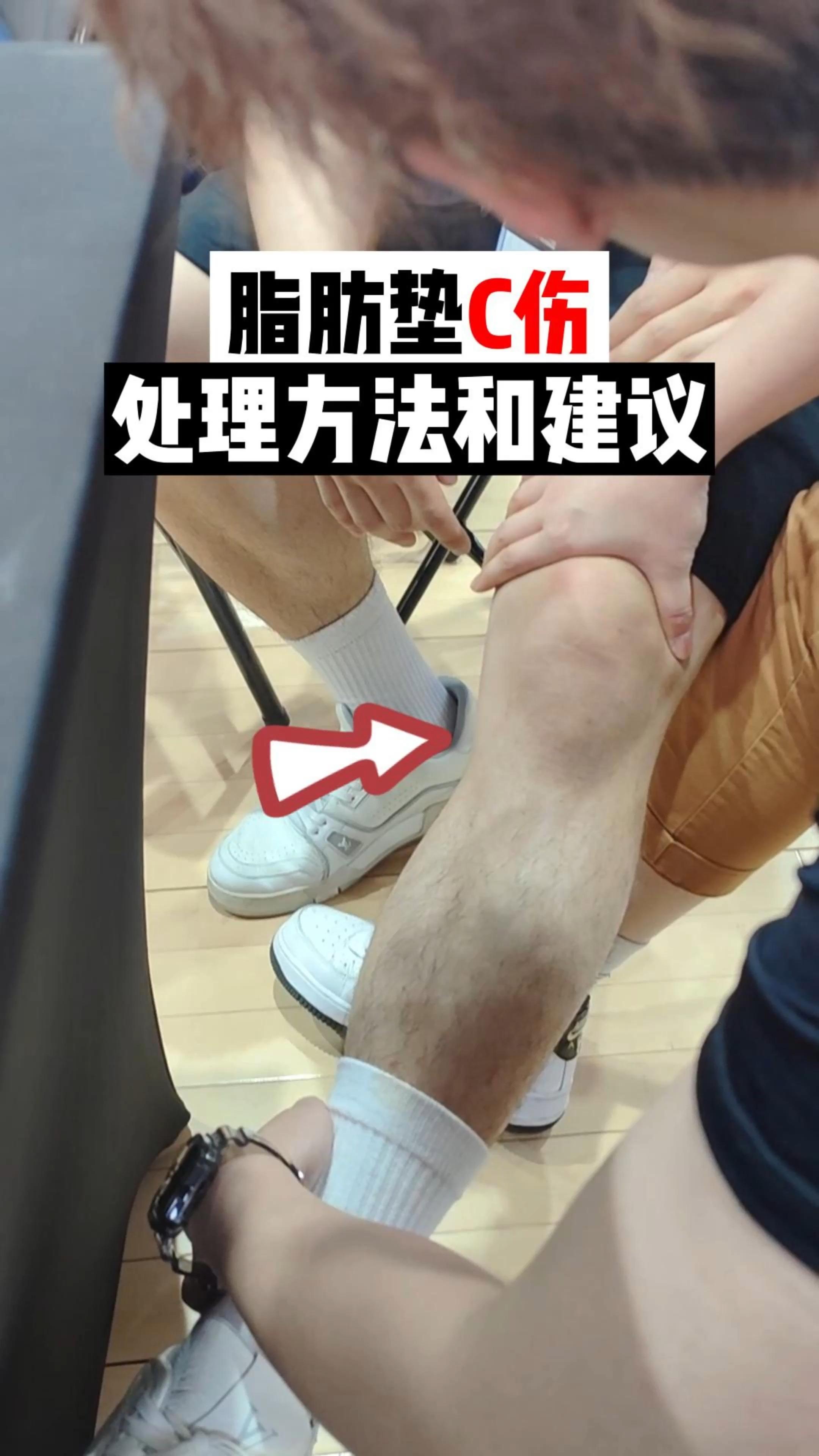 膝盖脂肪垫损伤