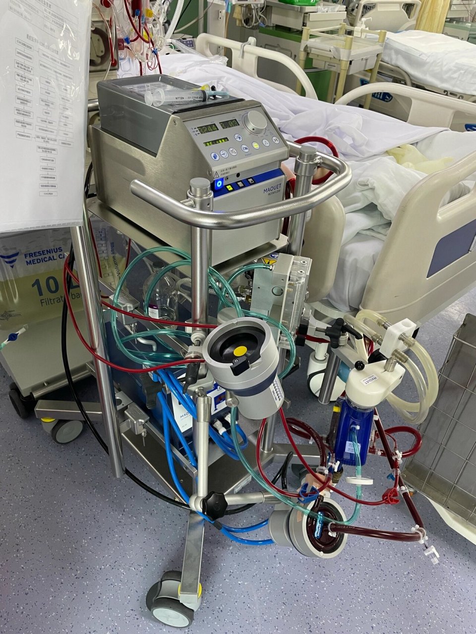 01危重症新冠肺炎患者的宝藏仪器 ecmo9399 ecmo-体外膜肺氧合