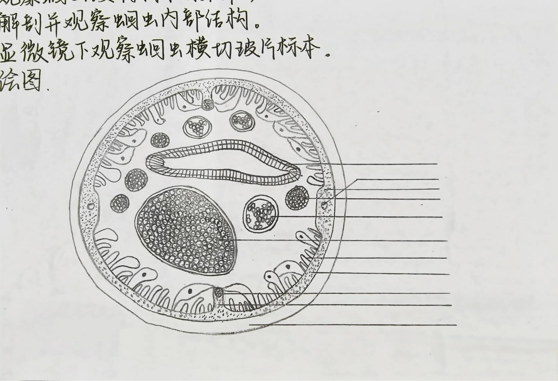 蛔虫的结构简图图片