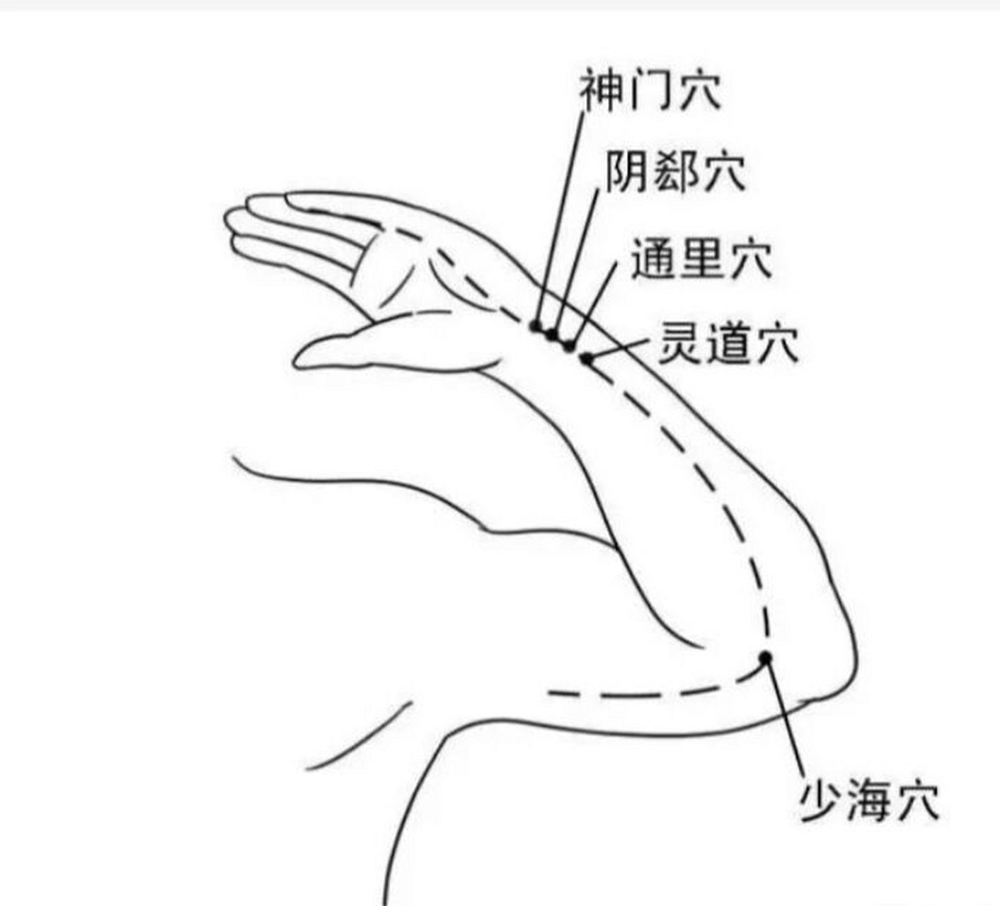 特效穴之腕部四穴:调心养神助眠 神门,阴郄,通里