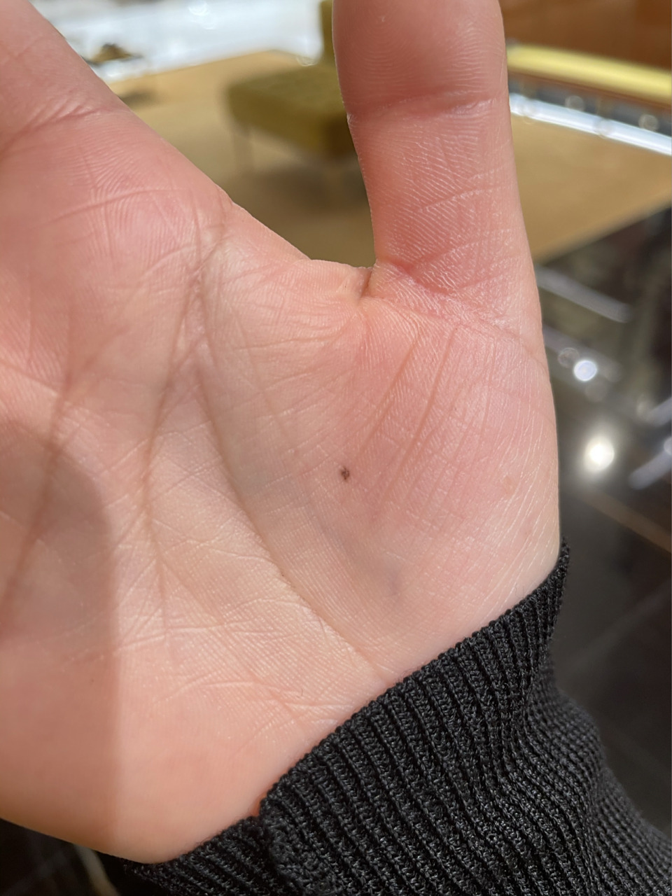 手心不知道什么时候长了一颗黑色痣 手心不知道什么时候长了一颗黑色