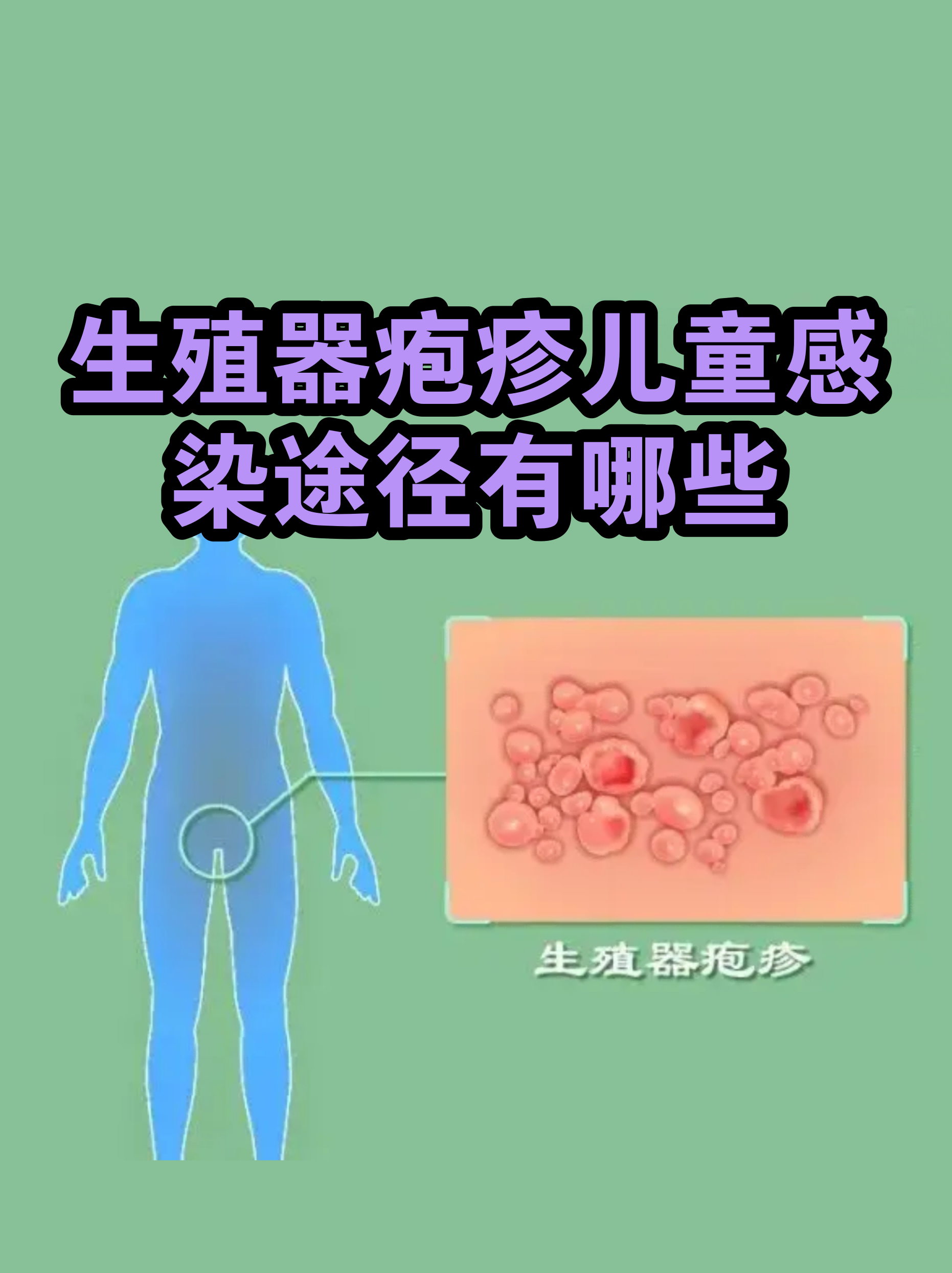  现在传染病毒最严重的是什么地方(现在传染病的情况怎么样)