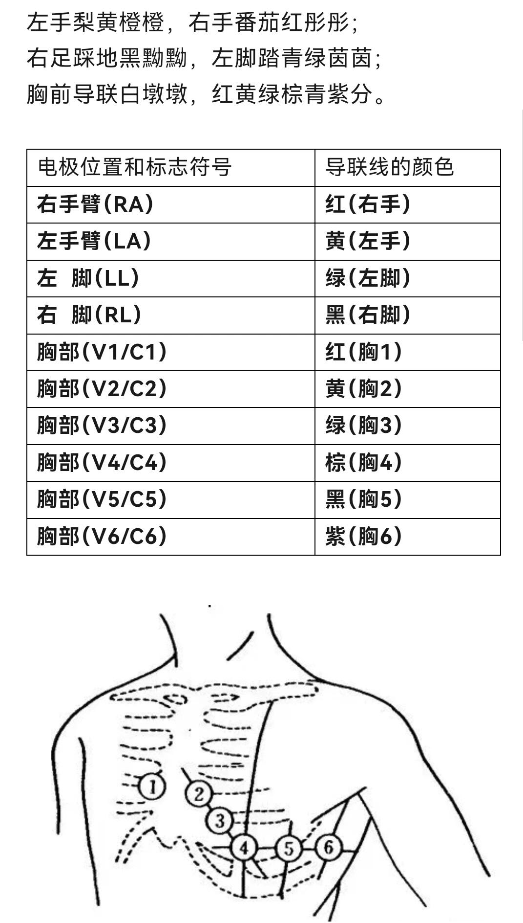 心电图导联颜色位置图片