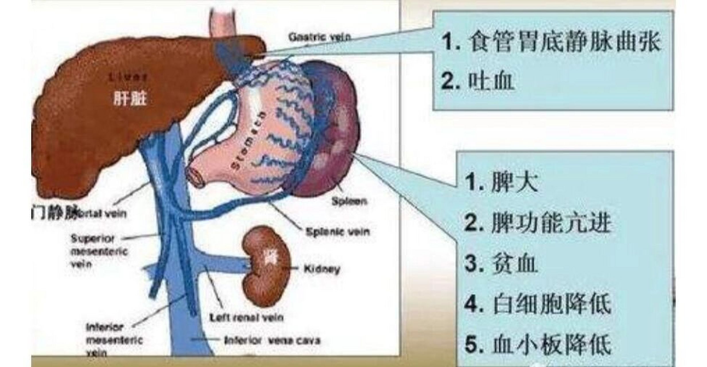 很多人做体检都会发现b超单上报告脾大,一般来说正常的脾脏厚度不