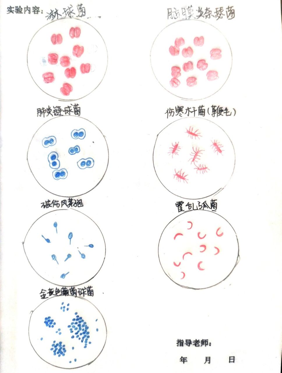 微生物实验报告 金黄色葡萄球菌 肺炎链球菌 脑膜炎奈瑟菌 淋病奈瑟菌