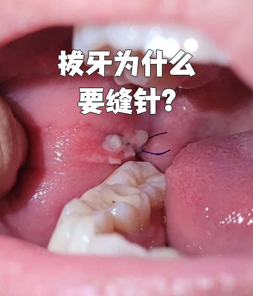为什么牙疼会在晚上更加严重百科在线