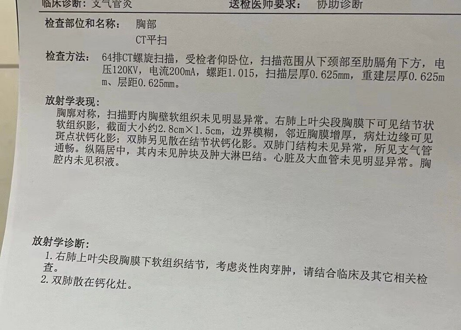 漏斗胸ct报告图片图片