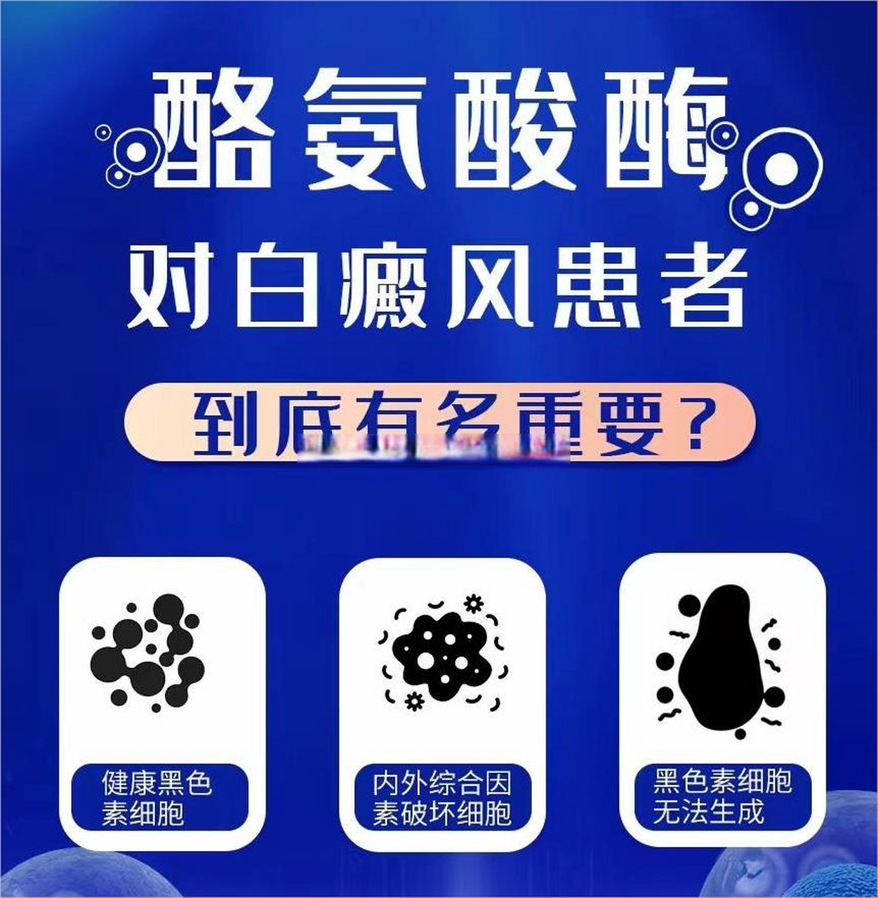 激活#酪氨酸酶# 疗法可以治疗#白癜风# 吗?