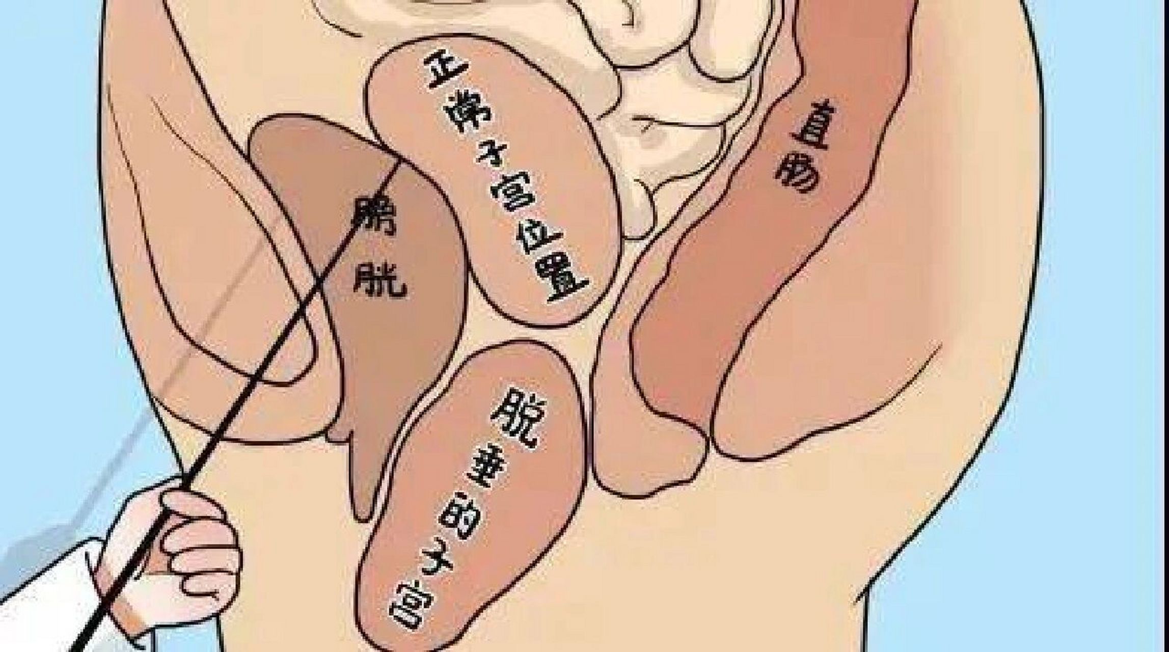 轻度子宫脱垂患者的福音,艾灸有良好效果 中医认为,子宫脱垂是由于