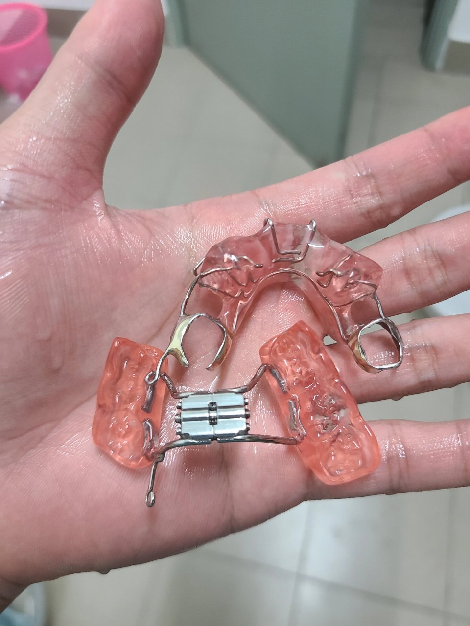 终于等到sgtb了,下巴后缩的救星 口腔正畸医学分为两个派系,一个是