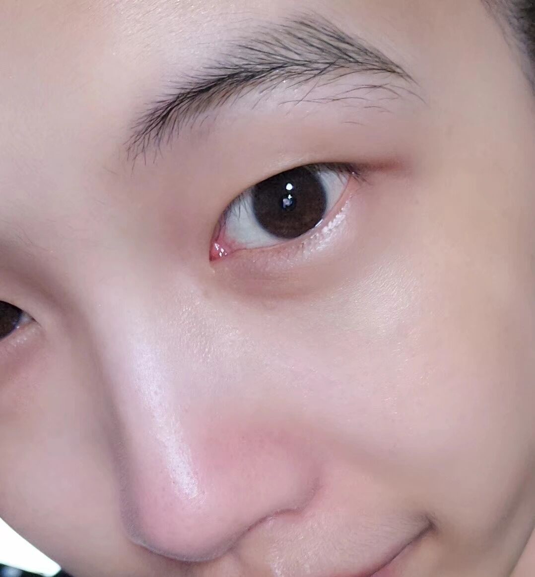 作为男生不长胡子感觉真是太好了 谢谢我的基因长唇毛可比长胡子好多