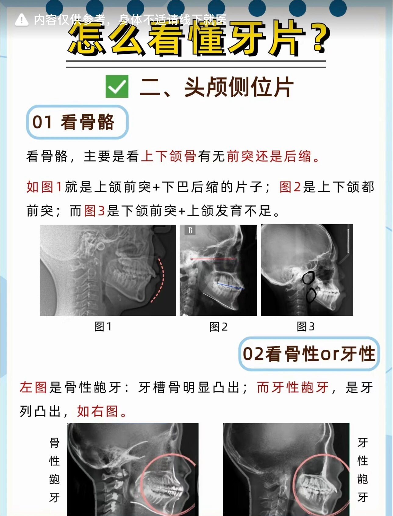 牙齿拍片解析图图片