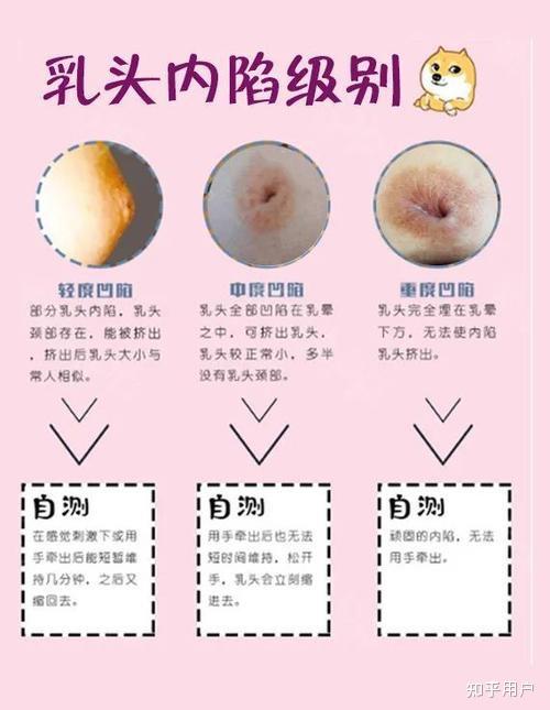 乳头正常真实有多大图片