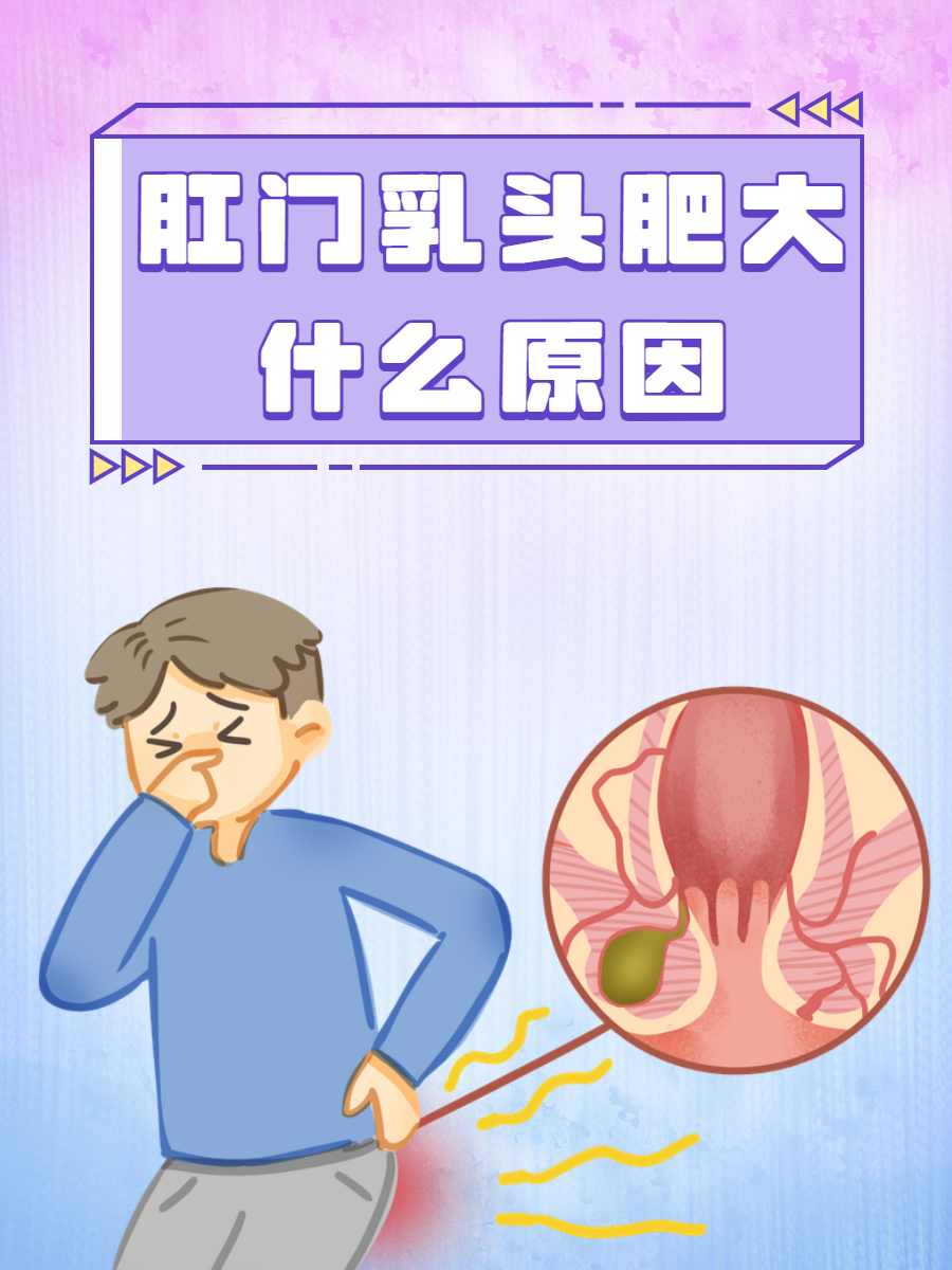 那么肛门乳头肥大的原因是什么呢?