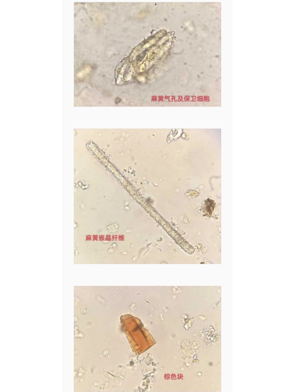 哑铃型保卫细胞图片