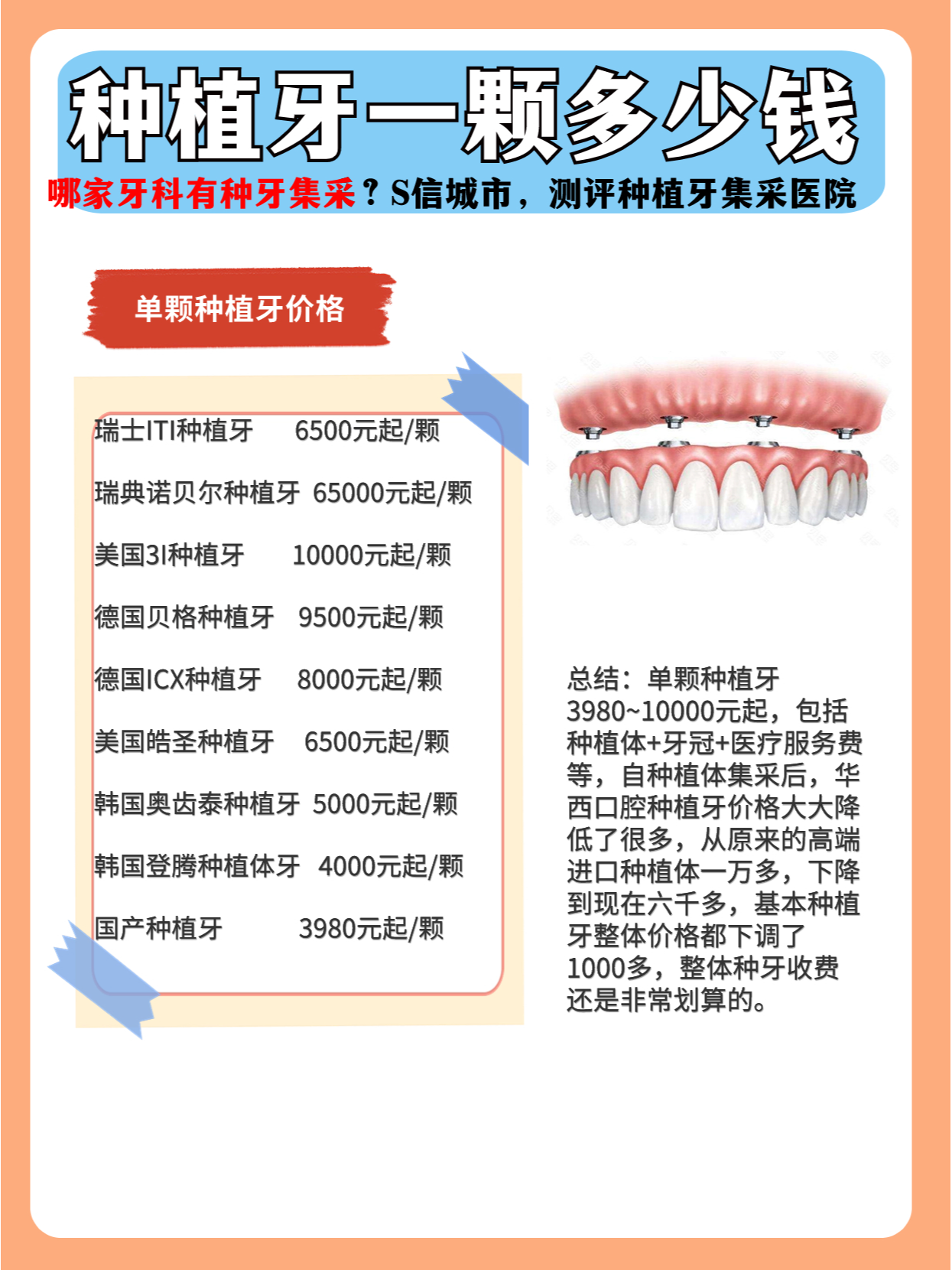 种植牙一颗多少钱90平民种植牙的福音快看 瑞士iti种植牙6500元起