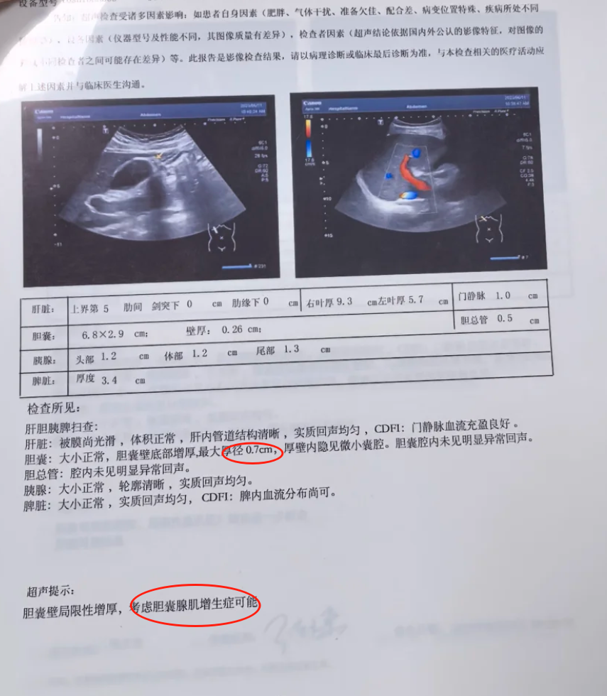 胆囊腺肌症小于10mm要不要手术,主要看患者的具体情况