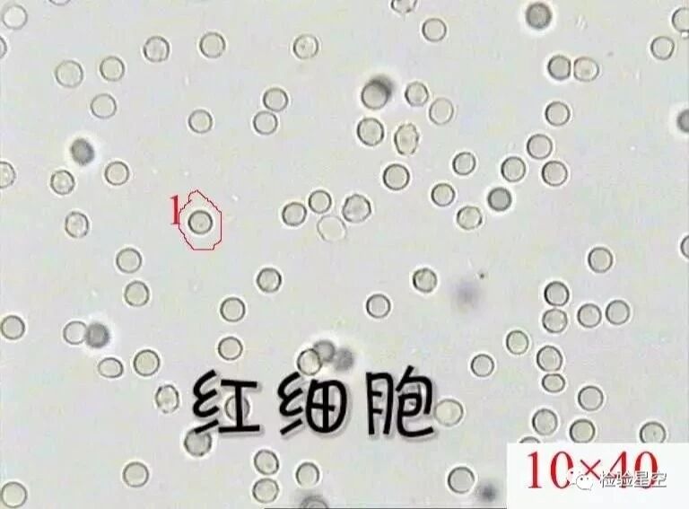 尿常规镜检图片图片