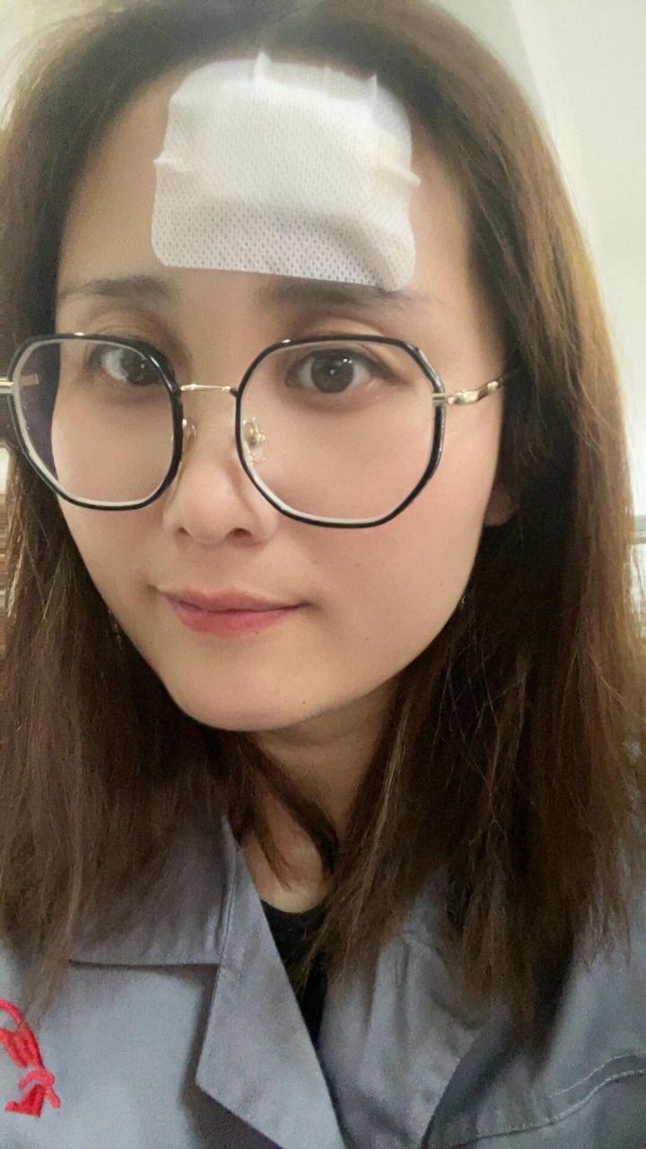 额头鼓硬包 犹豫再三,还是去把额头的脂肪瘤给割了,今天第二天,宁愿有