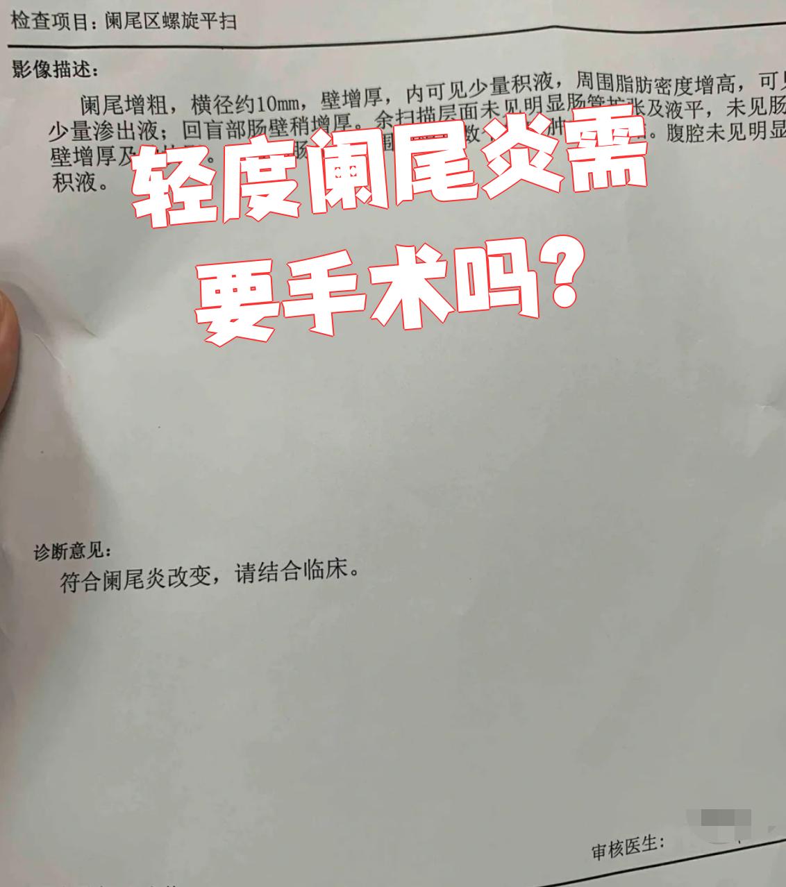 阑尾炎是阑尾发炎引起的疾病主要症状是右下腹疼痛发烧呕吐