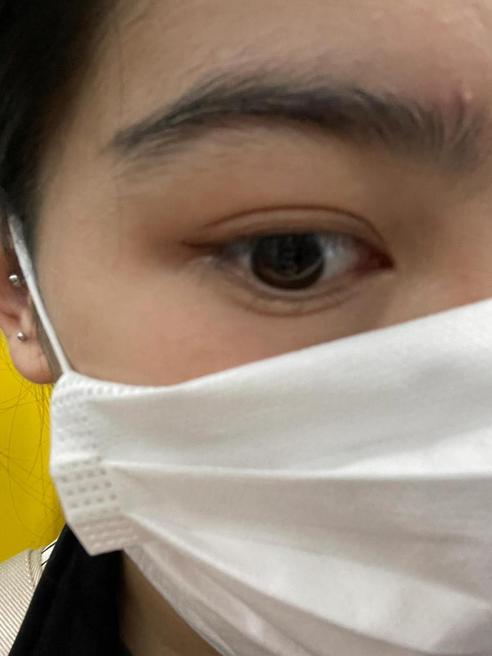 阴骘纹有被笑到 噗 有被笑到