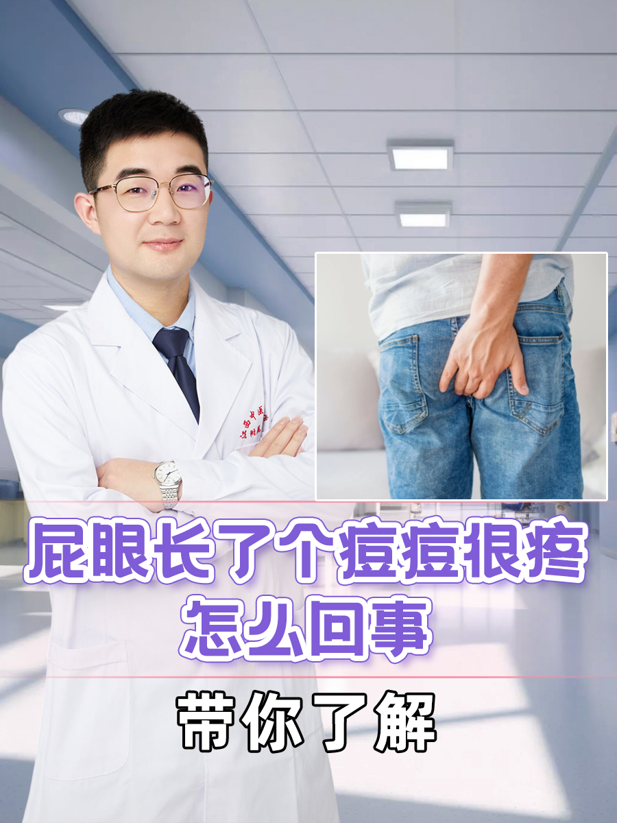 屁眼指的是肛门,平时不少人可能会遇到肛门周围长了个类似"痘痘"的