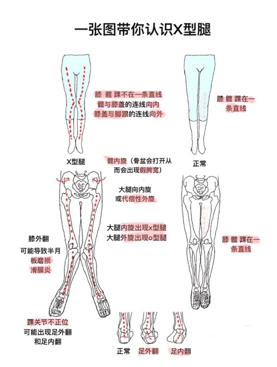 小腿型分类图图片