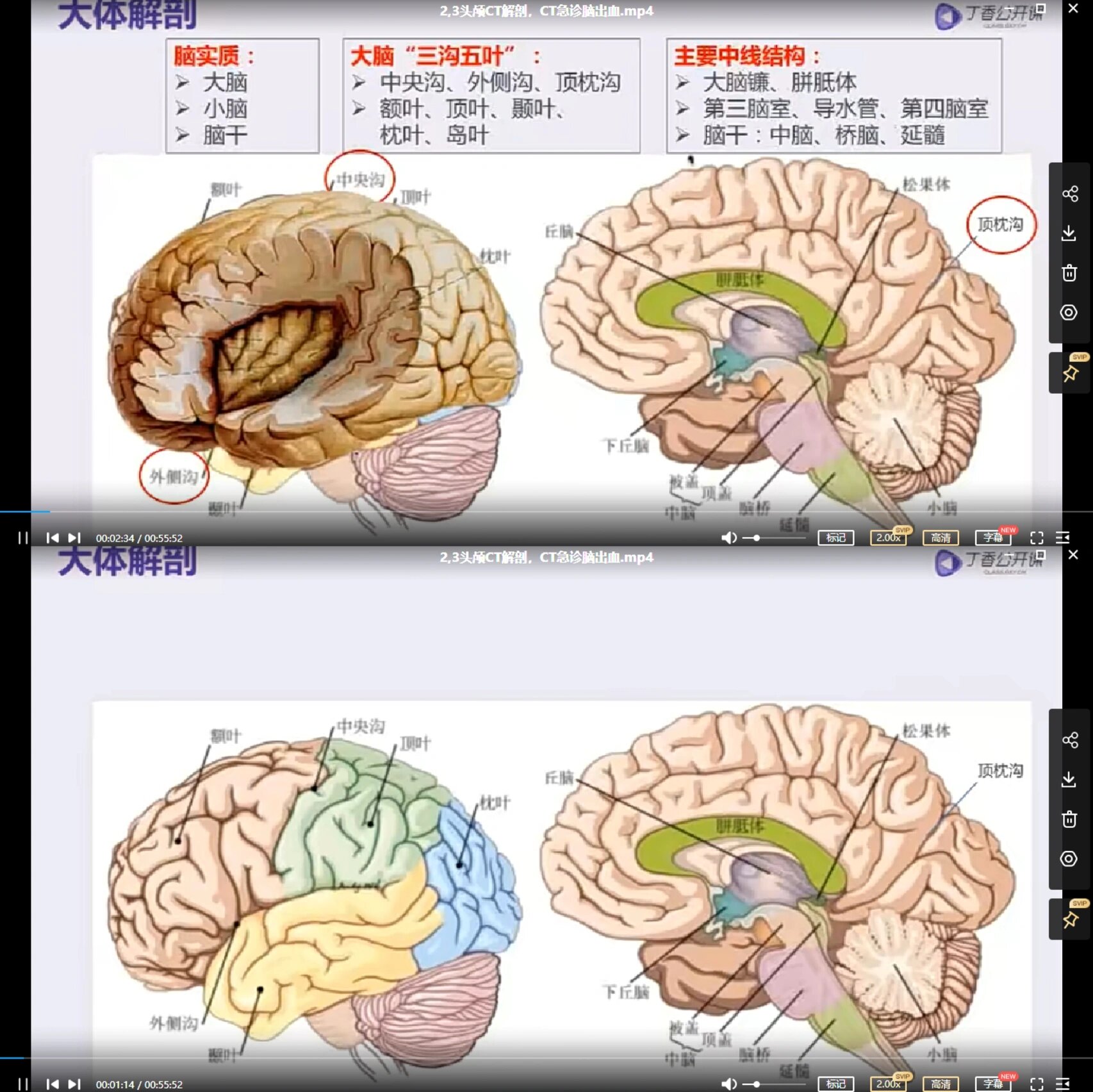 医学影像|头颅ct不同层面基本结构