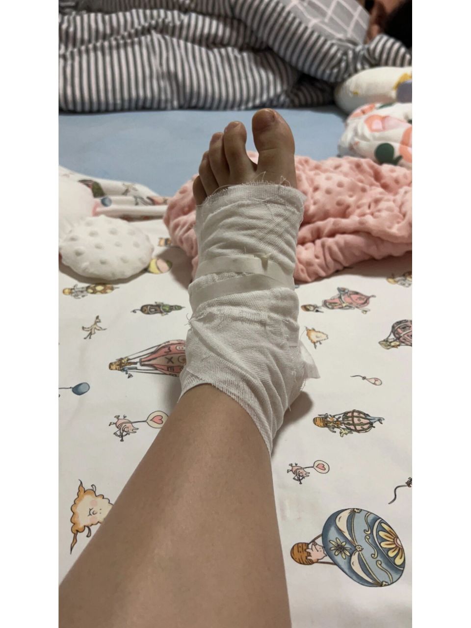 踢到石头,脚鼓包 走路玩手机的后果,鞋子又薄又软,踢到石头,感觉脚面