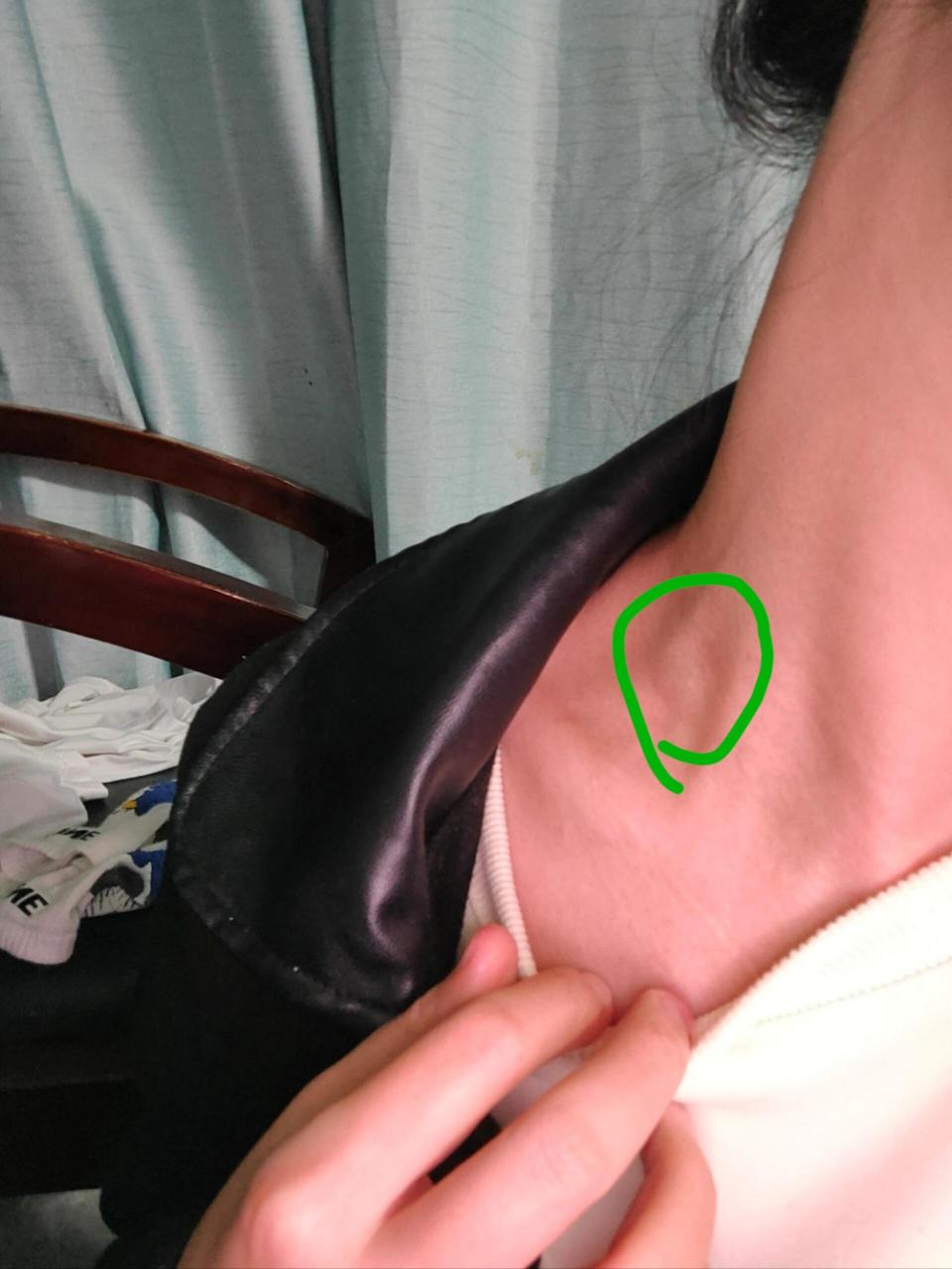 按压会痛 不动它就不痛 请问这是淋巴结嘛