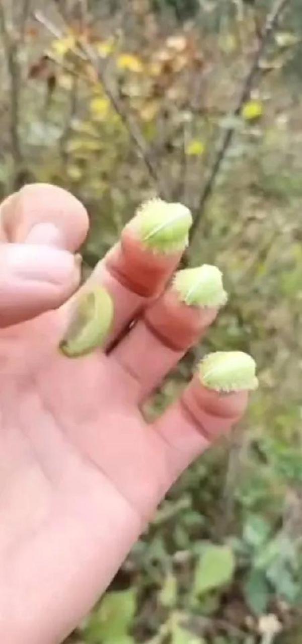 我们这里叫毛辣子,核桃树上长的一种小昆虫,蜇人一下,红肿热痛,好久