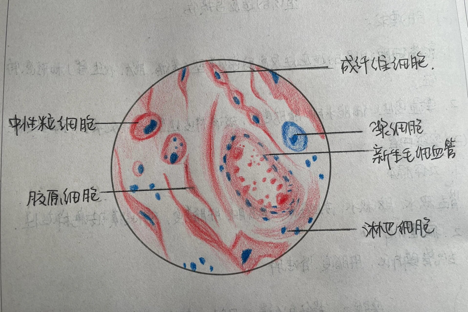 肉芽组织手绘图图片