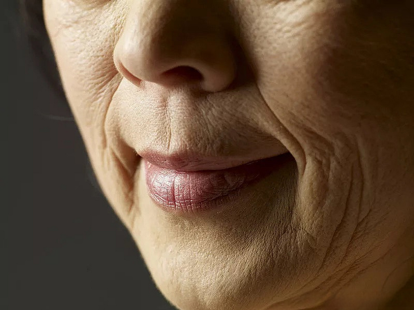 相较于法令纹,木偶纹的形成更加被视为衰老加重的一个指征,很多人宁可