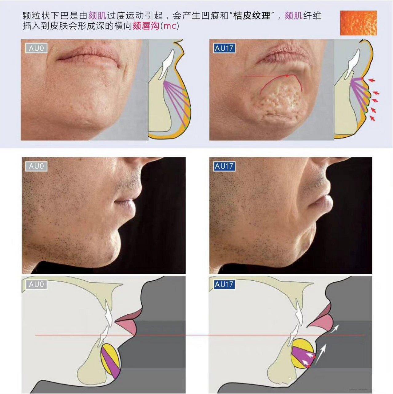 颏裂下巴图片