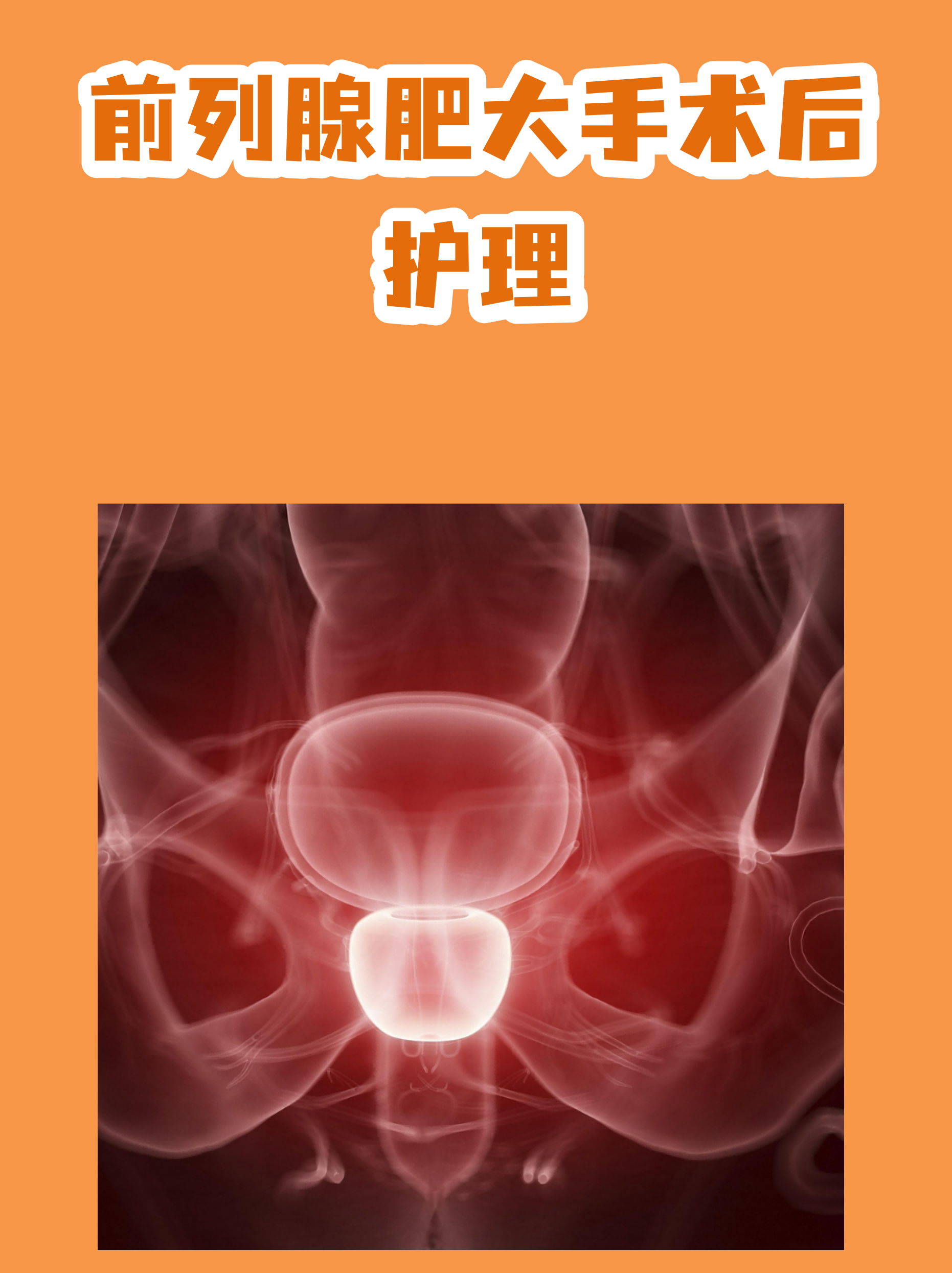 关于中国医学科学院肿瘤医院预约检查陪诊挂号出院居家护理提醒,科学恢复身体的信息 关于中国医学科学院肿瘤医院预约检查陪诊挂号出院居家护理提醒,科学恢复身体的信息