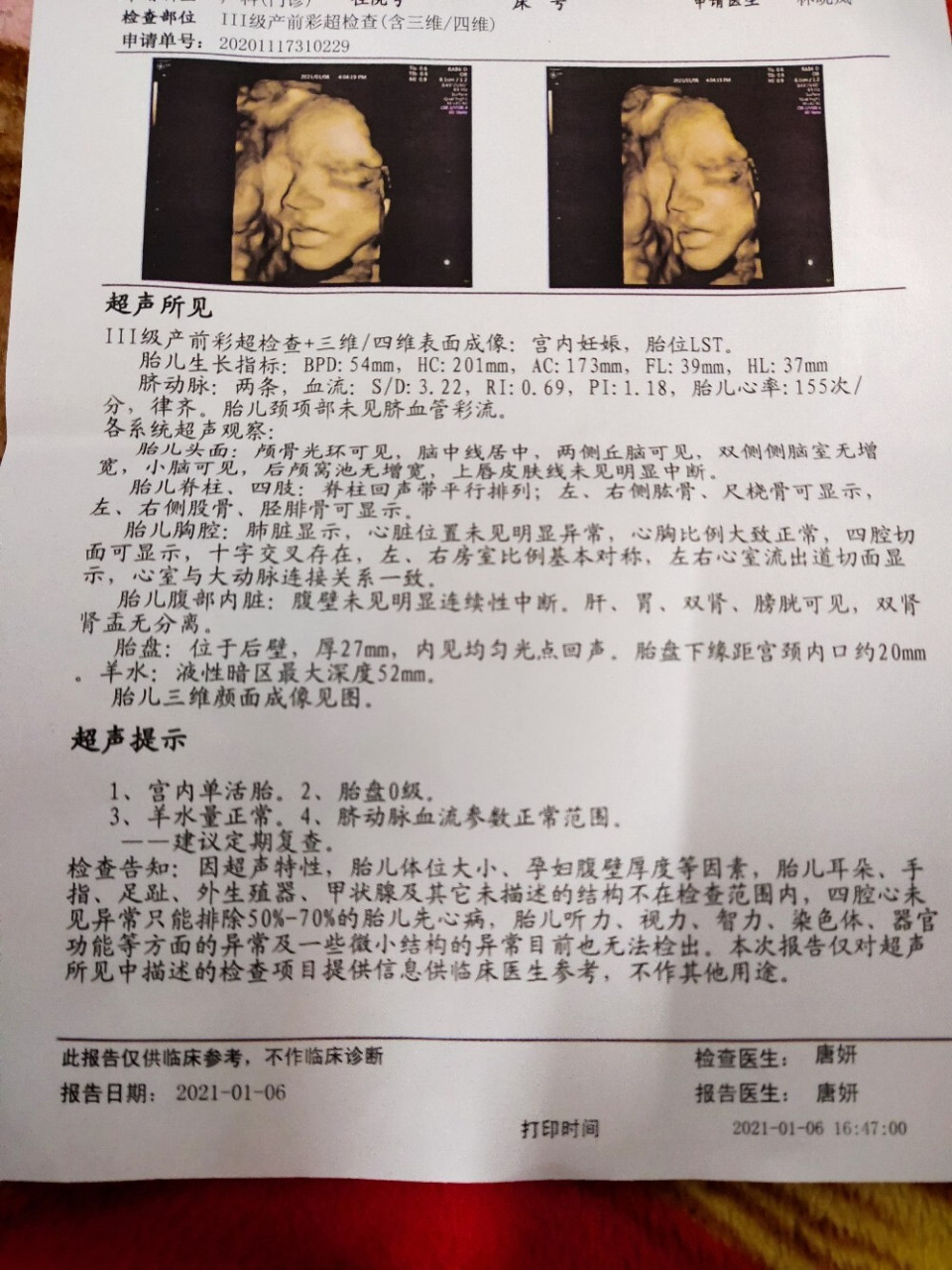 四维一次过 来来看看男宝还是女宝
