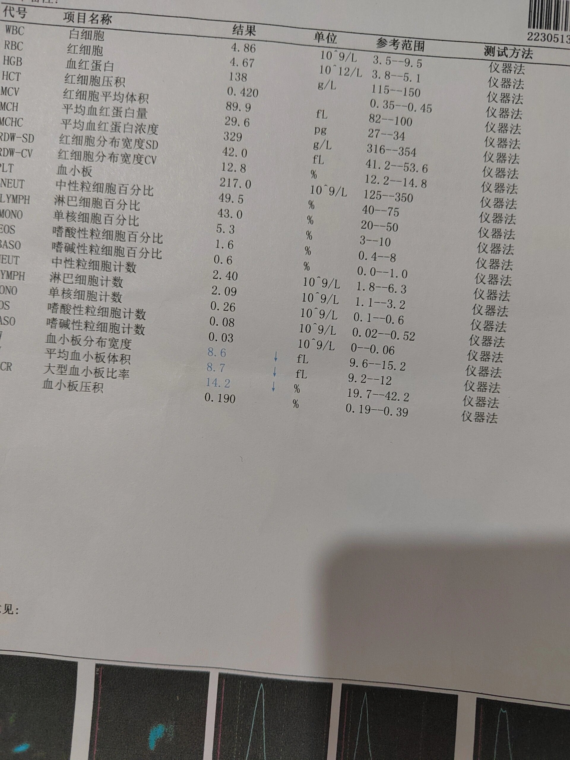 大血小板数目图片