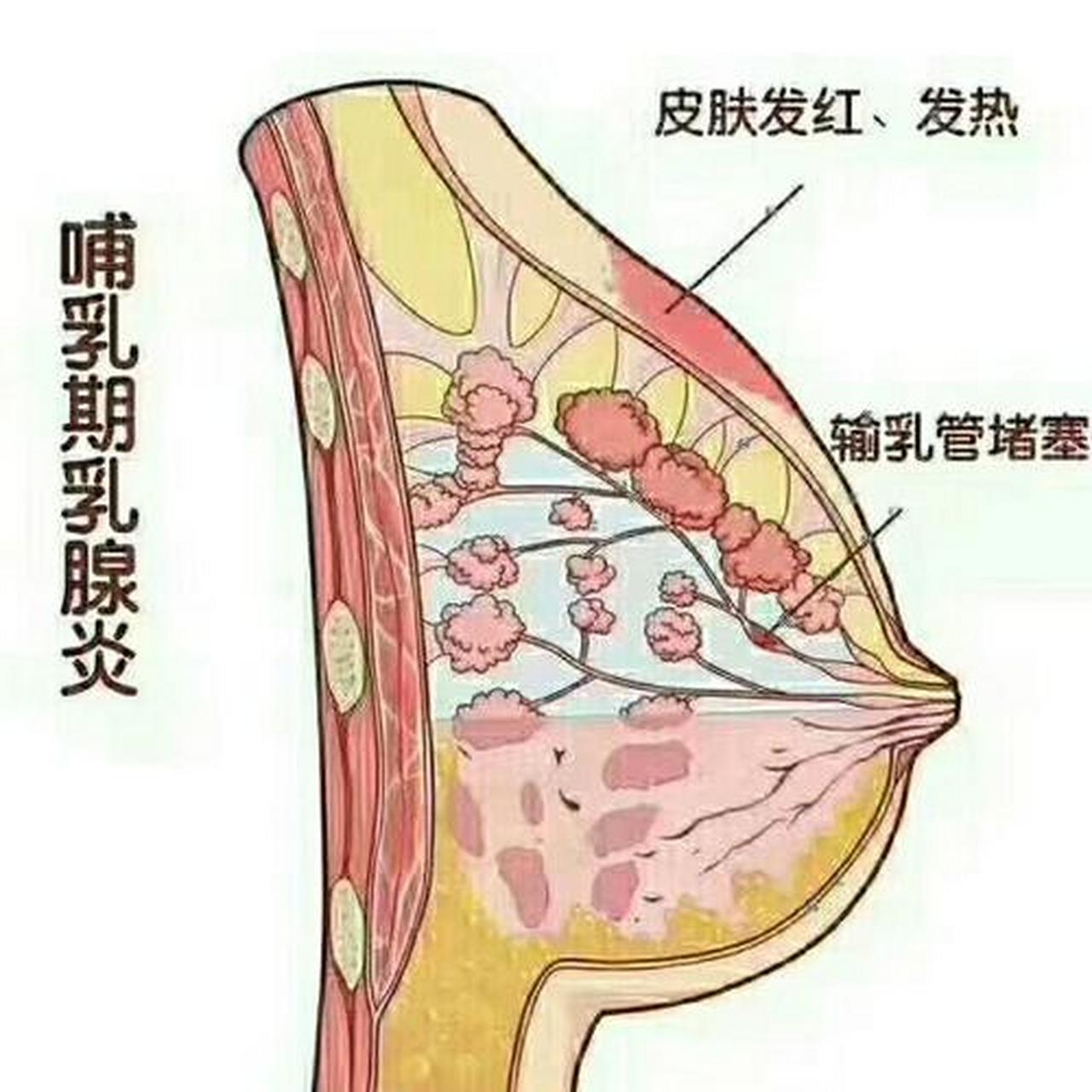 哺乳期乳腺管分布图图片