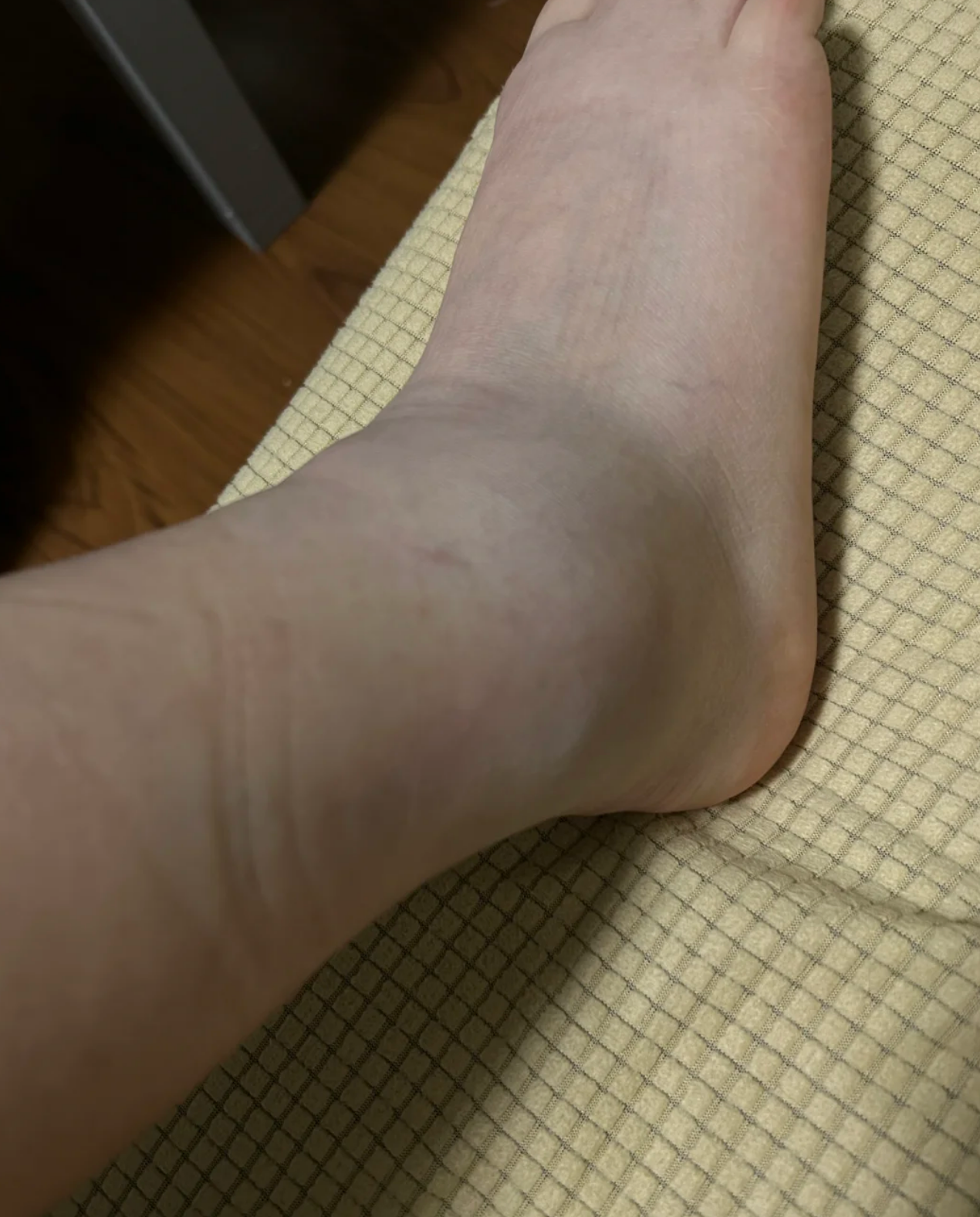 脚为什么肿 脚为什么肿