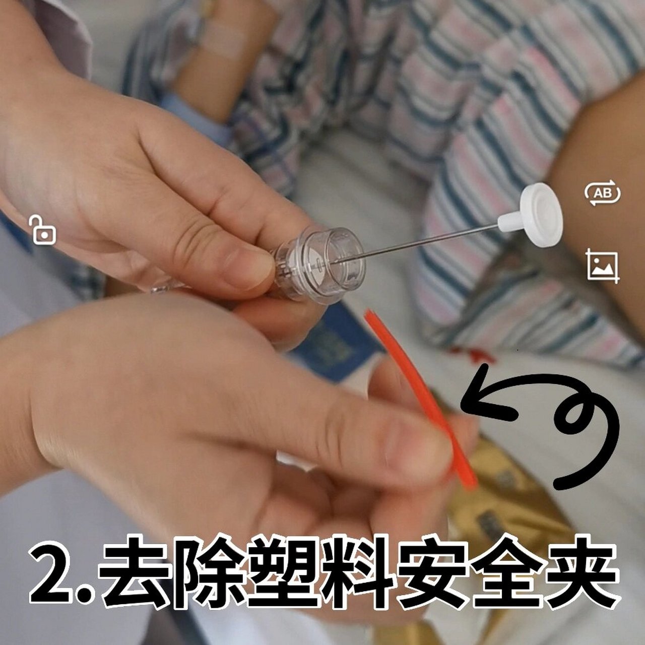 戈舍瑞林注射腹部图图片