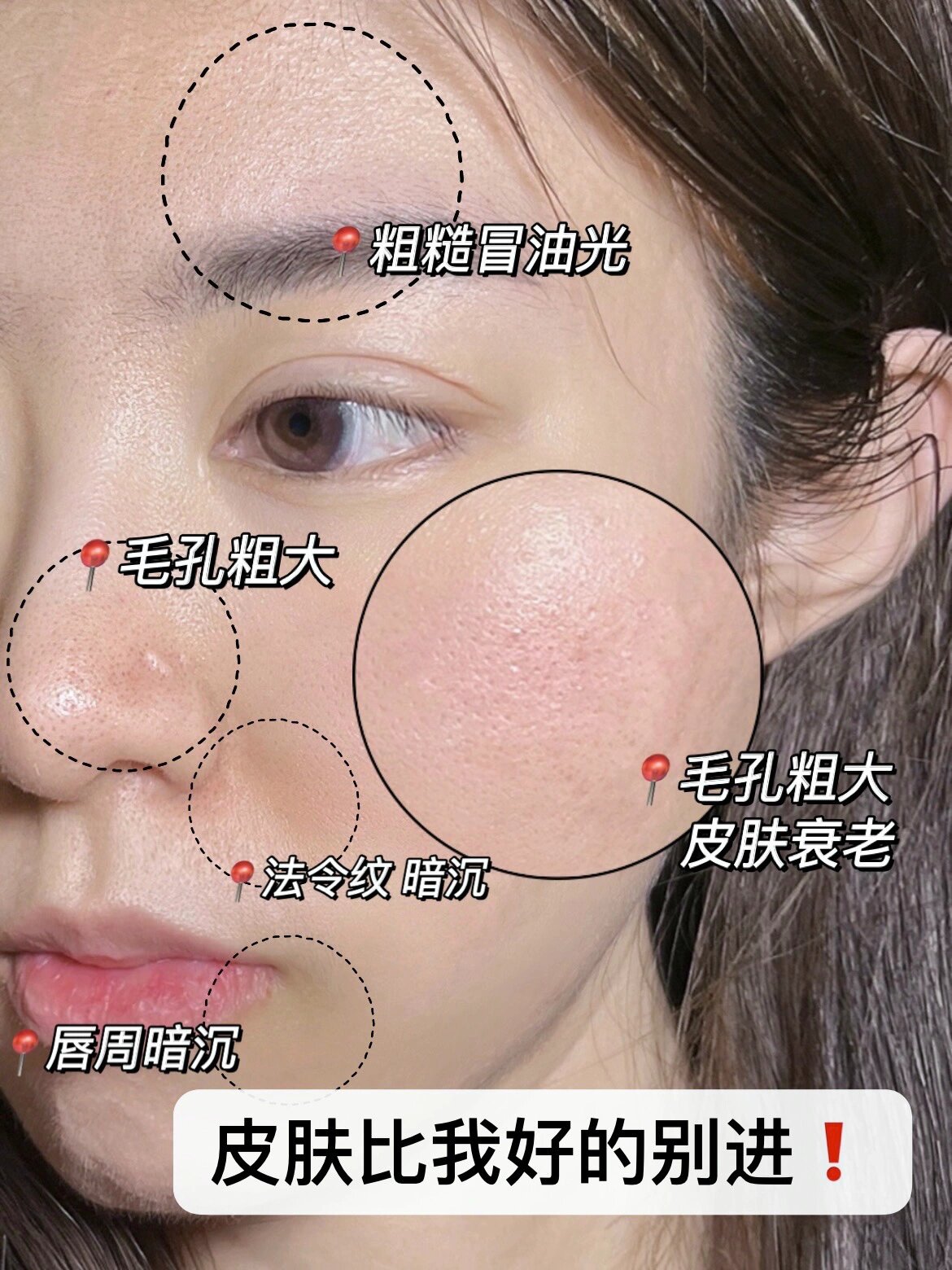 我之前的皮肤真的是照镜子会难过的程度 不知道有没有和我同款肤质的
