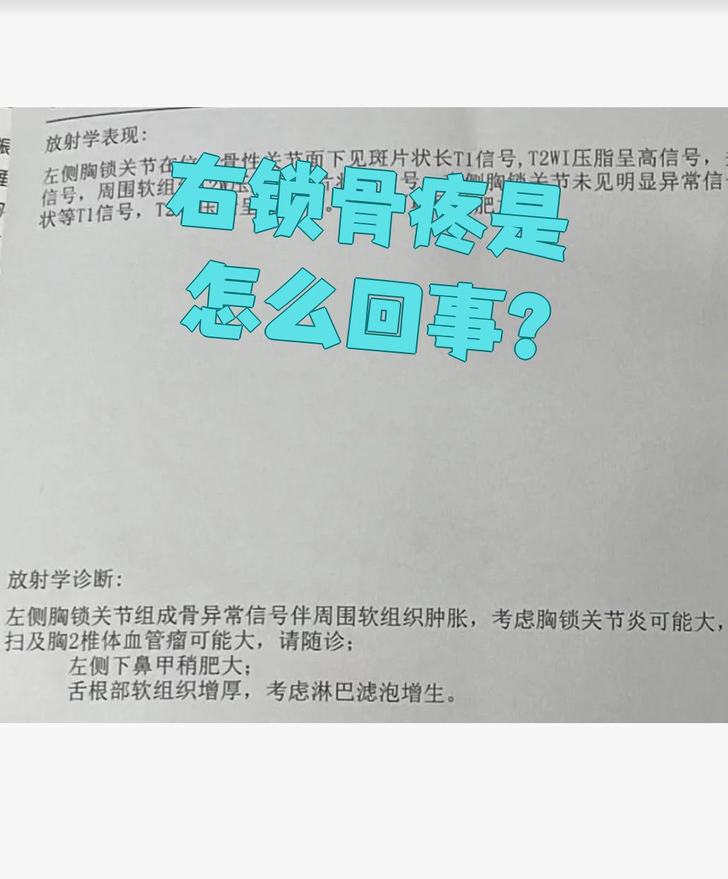 右锁骨疼常见原因有受凉,外伤或胸锁关节炎,不同原因处理方法不一样